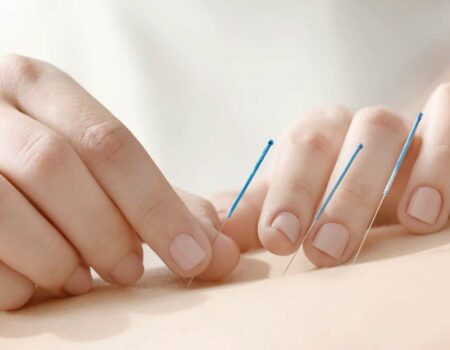 Can acupuncture assist with infertility issues?