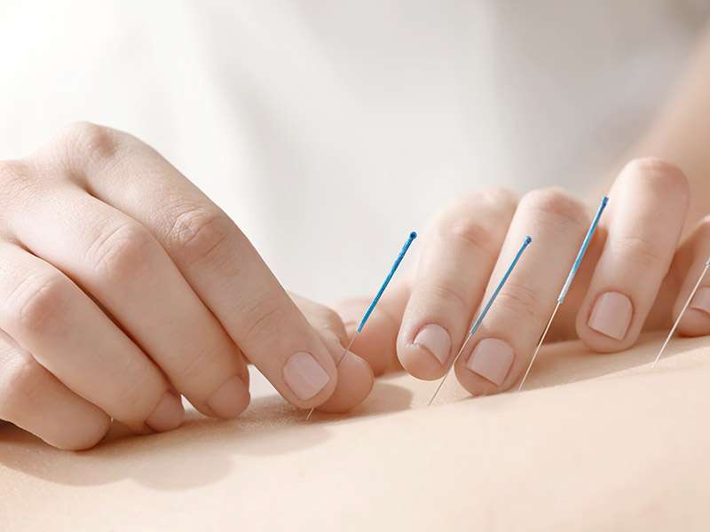 Acupuncture - Main Line Fertility