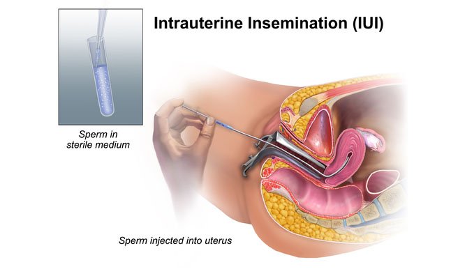 ovulation